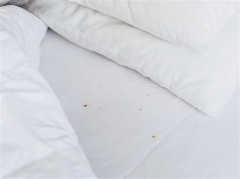 Bed bug stains on mattress. Things To Know About Bed bug stains on mattress. 